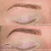 Is Microshading better than microblading? - MIcroblanHolistic Health and Laser Hair Removal Clinic