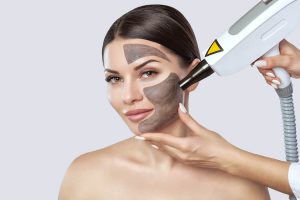 Pico Carbon Laser Peel - Holistic Health and Laser Hair Removal Clinic